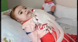 SMA Hastalarının Tum Masraflarinı Devlet Karşilayacak